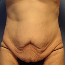 pre-op @ the clinic