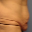 pre-op @ the clinic