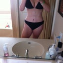 same black bikini as pre op 10 days later 139