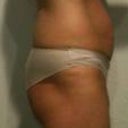 PRE OP- side view WOW check that major dent in my butt....not to mention the tummy :)