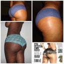 1 of 6 collages I showed Dr. P