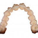 Rosie's top teeth (from left to right) - beginning of Treatment Sept '08 - Middle of treatment Feb '09 - and July '09.