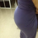 Me from the back 8 days post op