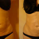 Front - Before and After