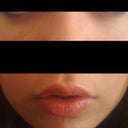 this is my latest touch up, only on upper lip... haven't touched the under eyes since May 08