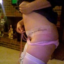 day 5 post op