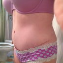 4 weeks post