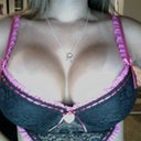 exactly one month post op.