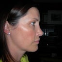 Side view 5 months after original