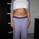DAY 16 POST OP