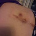 When the pain started Nov 2011