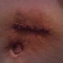 The surgery 2012 new cut;(