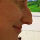 Side Smile