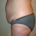 Left side is so much bigger than my right side