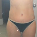 7 Weeks Pic - Maybe at 10 weeks I will wear a bathing suit.  Gotta get a tan first.