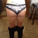 After 1 fat transfer