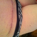 I love how low and neat my scar is