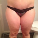 Before pics of thighs