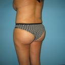 6 mos after