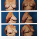 My before & after pictures.