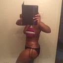 u can see the lump on my side where im still swollen from lipo of the flanks