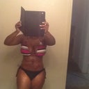 No Mt, just TT and full lipo on my stomach  and flanks..i didnt need it
