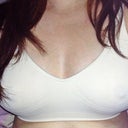 10 days post-op wearing an Amber crop top.  My breasts are still swollen.