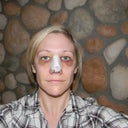 Day 2 post op. Lovely pig nose filled with gel. Wanted to post this because most people don't know this is normal the first week because the splint pulls the nose up to help the base heal.