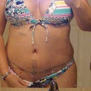 front view one week po