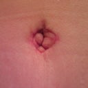 belly button at 1 month po