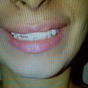 hardly can see my teeth on the right.. no laugh line.. :(