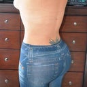 4 weeks post-op in jeggings