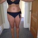 Before smart lipo