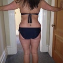 Before smart lipo