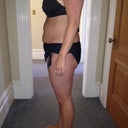 Before smart lipo