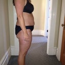 Before smart lipo