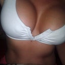 1 Month Post Op