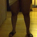 My legs four days later. My legs look better now but they're still swollen.