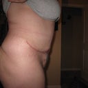 6 weeks Post-Op