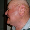 With the Turkey neck gone.
