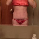 24 Days Postop