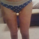 4 weeks out from skin removal from the thighs.  4 #s of skin removed!