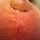 3.5 weeks, righty