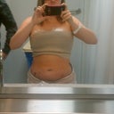 The Day After my surgery, fixing to head home...
