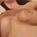 7 months post op 
This is a photo of the right breast, taken in a mirror. Close to the sternum is where the intense burning is. This was said to be FINE and the way it should look by my surgeon.