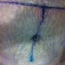 And here it is post-ops. I love that my incisions are thin.