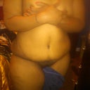 Day 15 day po tape off but very swole lower tummy, groin and right above hips