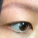 after 2nd application, 1 more to go!
