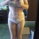 day 2 - lots of swelling
