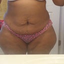 My front, or shall I say my skin